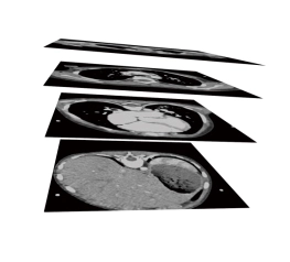 CT/MRI data processing