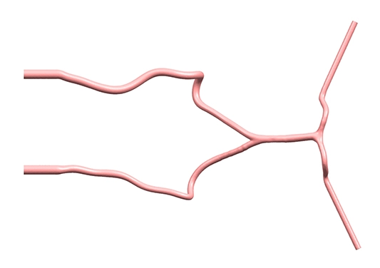 Drawing of Posterior Cerebral Circulation Vessel Model