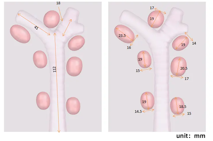 Drawing of Endobronchial Ultrasound (EBUS) Training Model