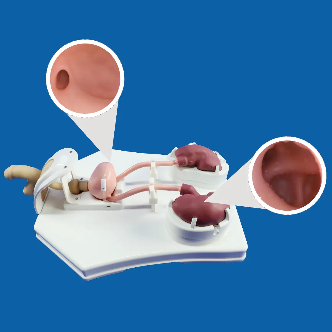 model of human urinary system
