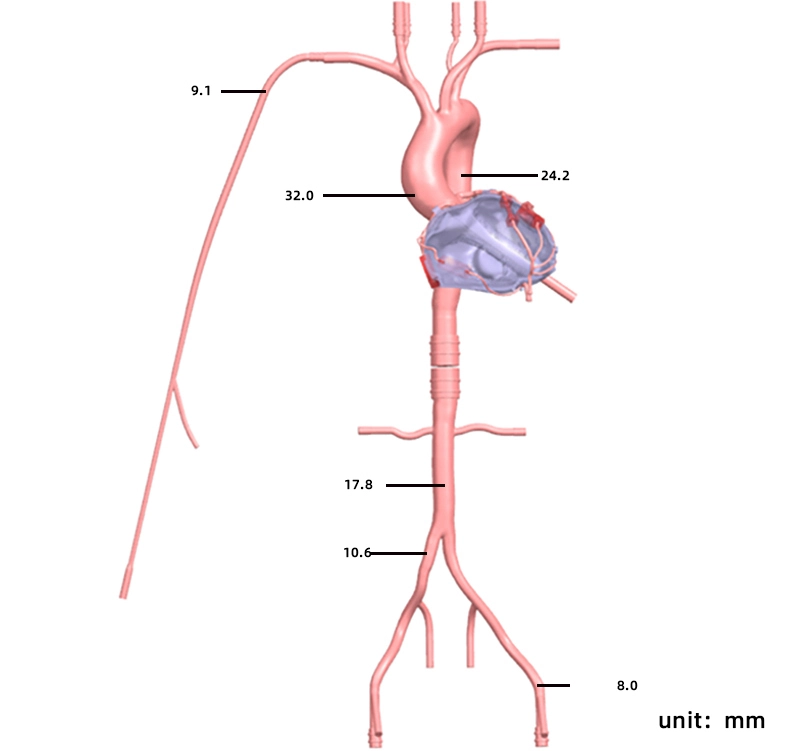 Drawing of Coronary Artery Simulation Model