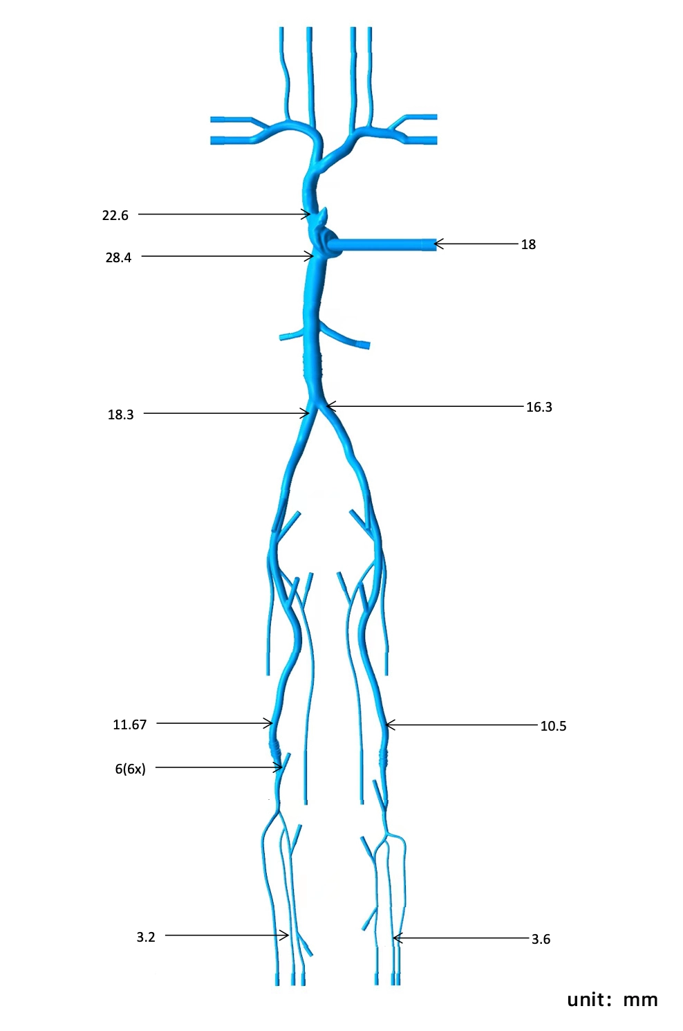 Drawing of Superior And Inferior Vena Cava-Lower Extremity Vein Simulation Model
