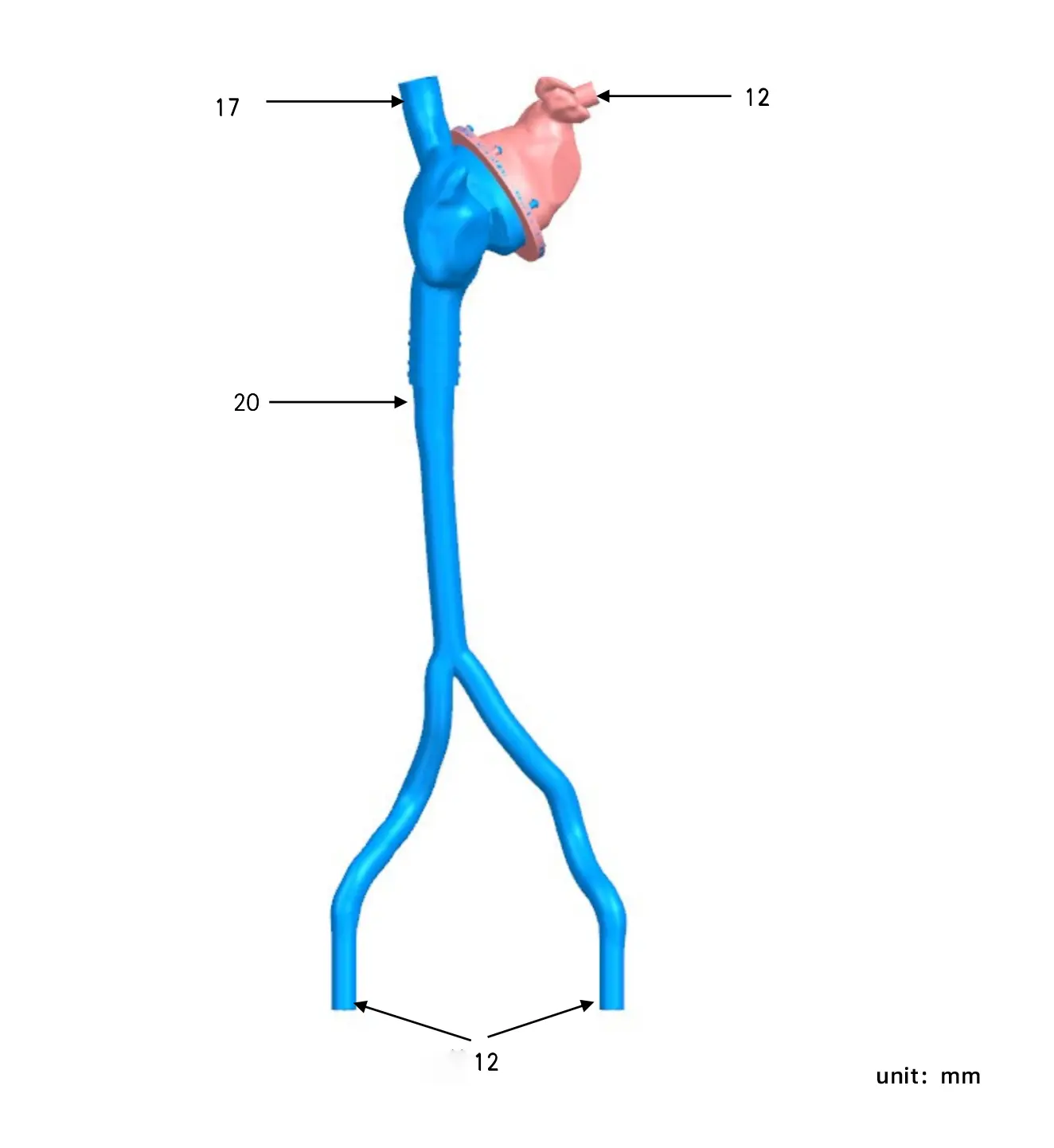 Drawing of Left Atrial Appendage Vessel Model