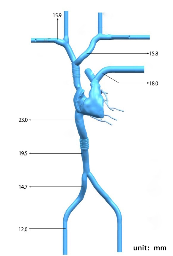 Drawing of Cardiac Veins Simulation Model