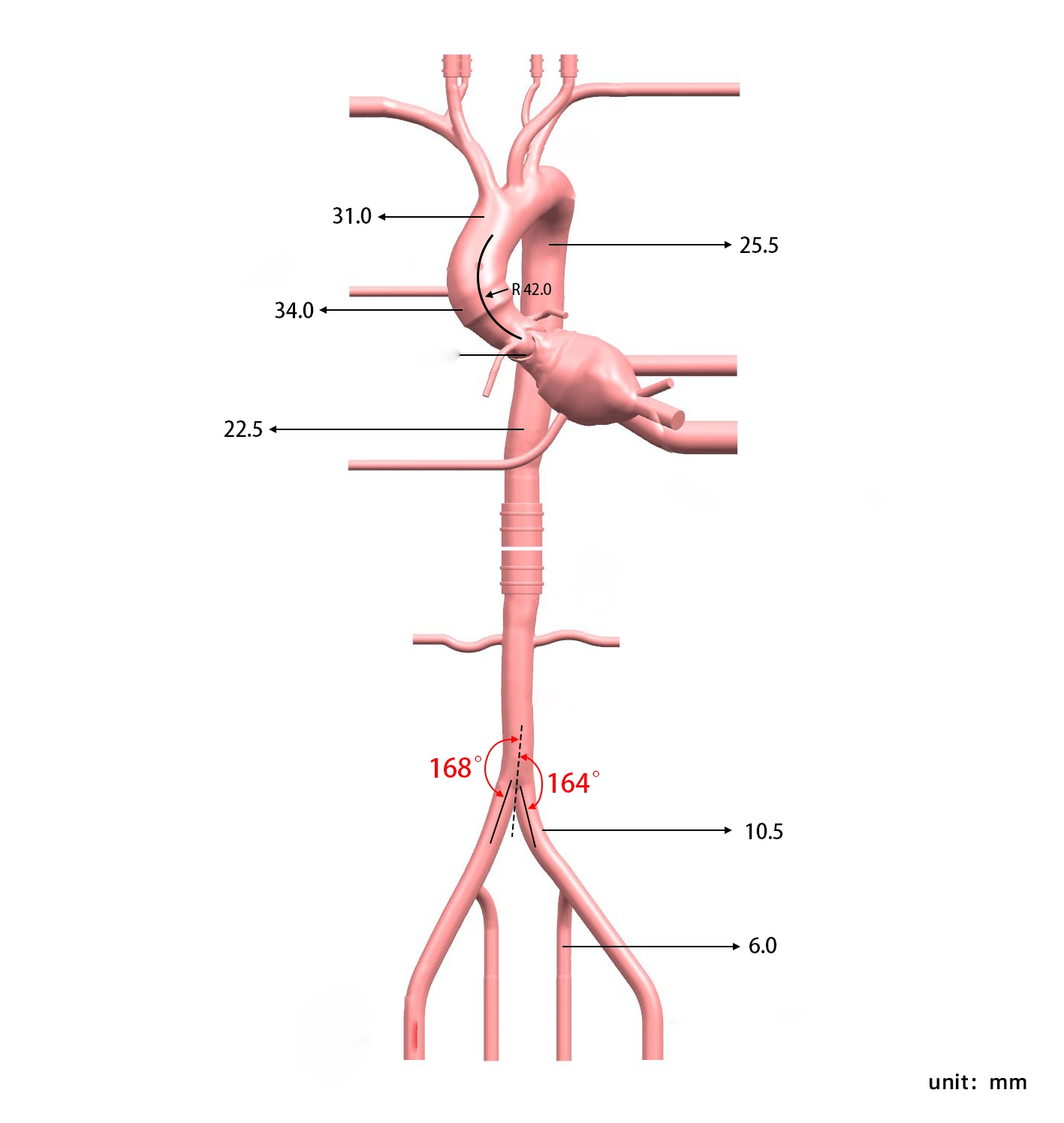 Drawing of TAVR Simulation Model