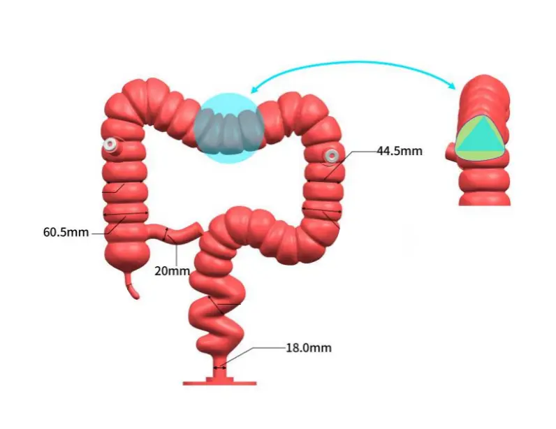 Drawing of Colonoscopy Training Model