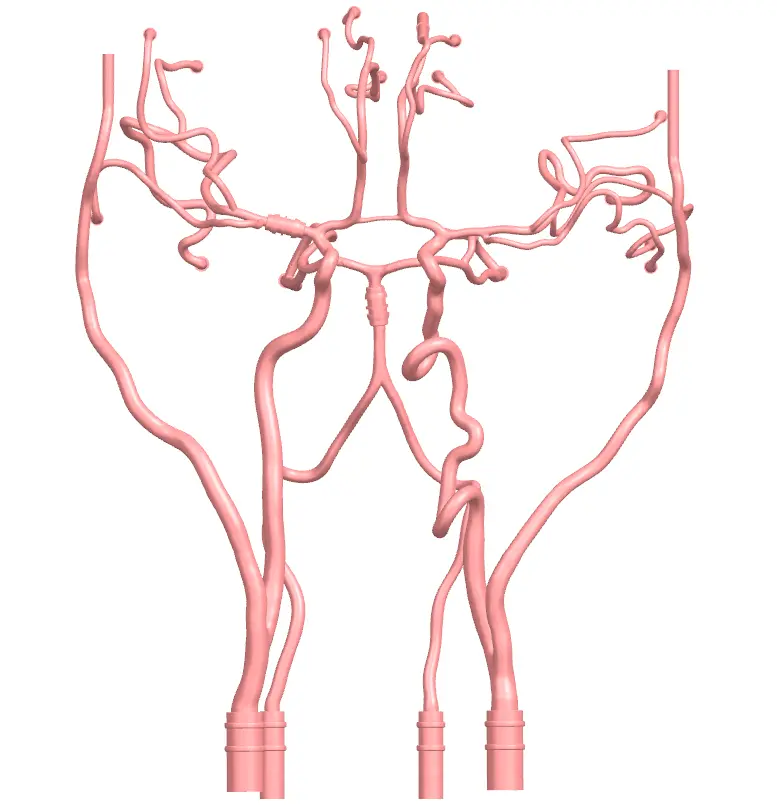 Drawing of Intracranial Vascular Model-type B