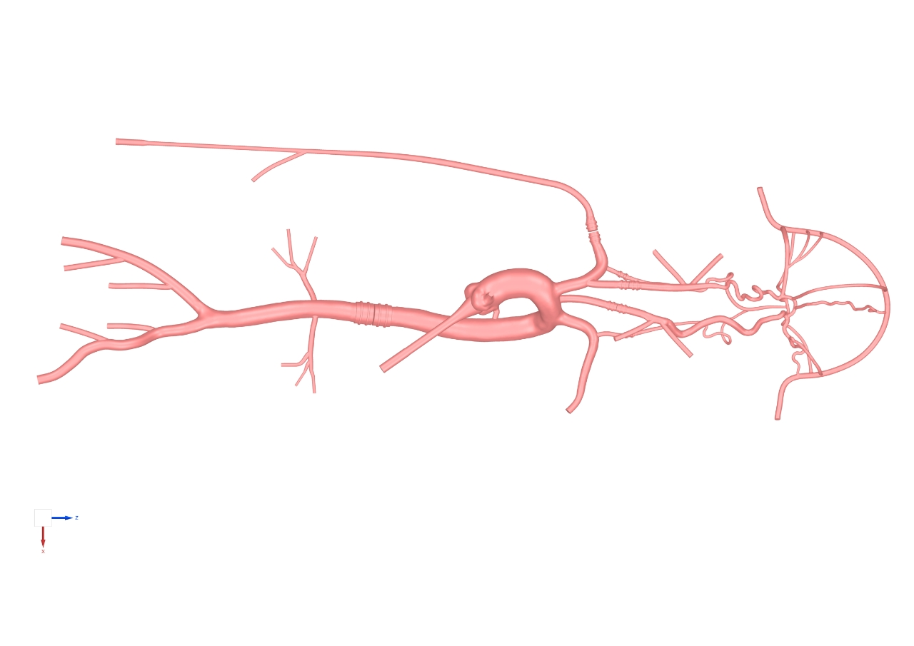 Drawing of Intracranial Vascular Model-type C