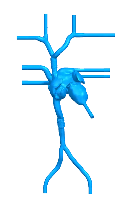 Drawing of Transseptal Puncture Vessel Model - Type A