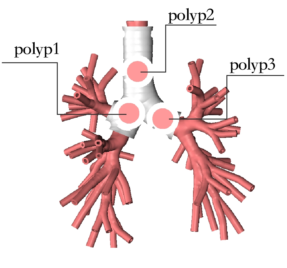 Drawing of Endobronchial therapy training model