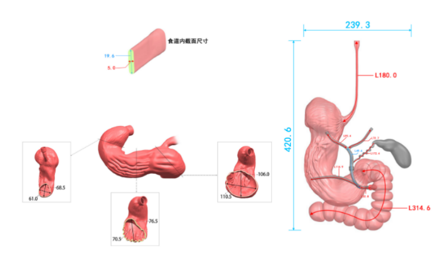 Drawing of ERCP Training Model