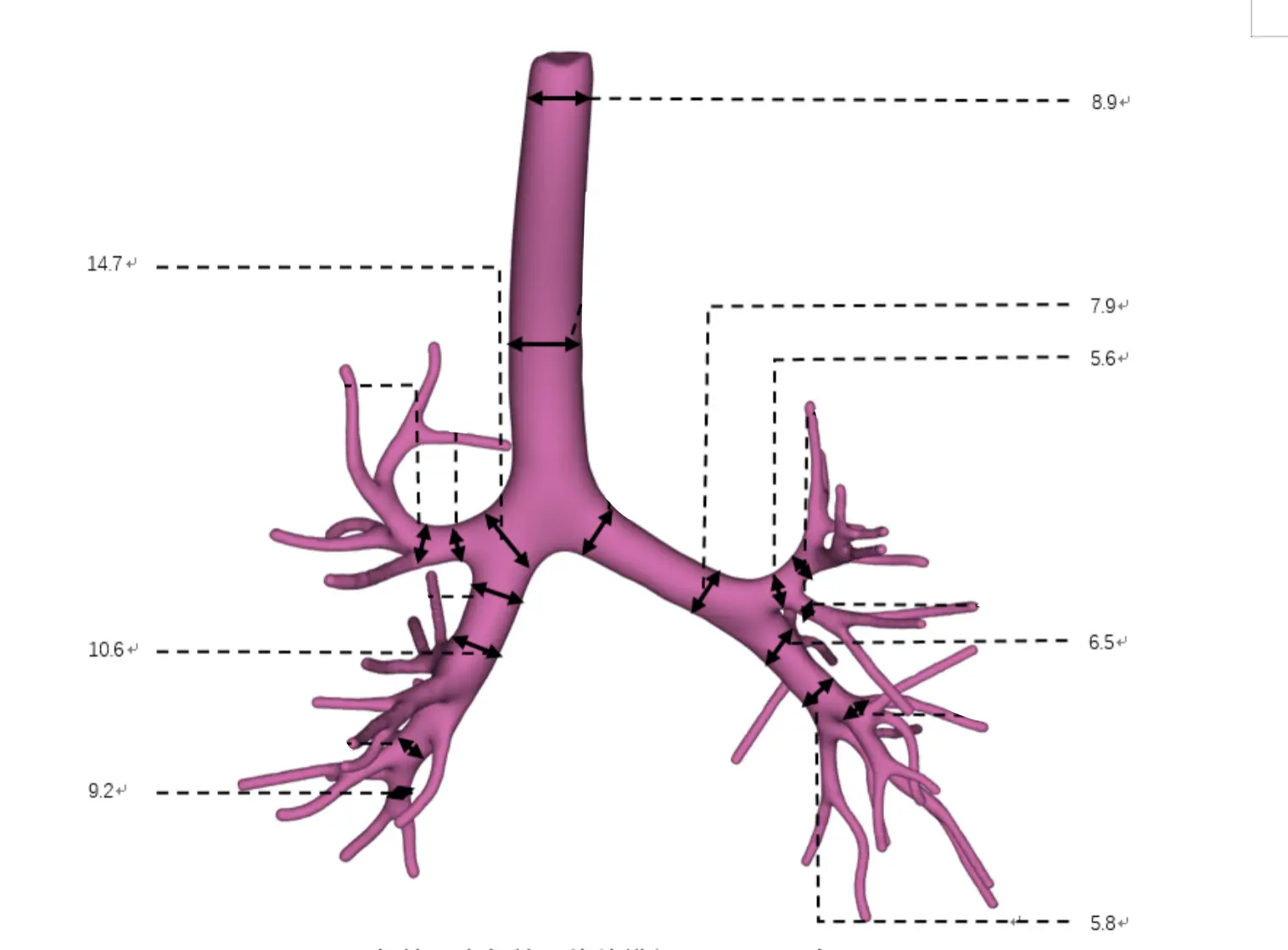 Main Dimensions of Pediatric Bronchoscope Training Model