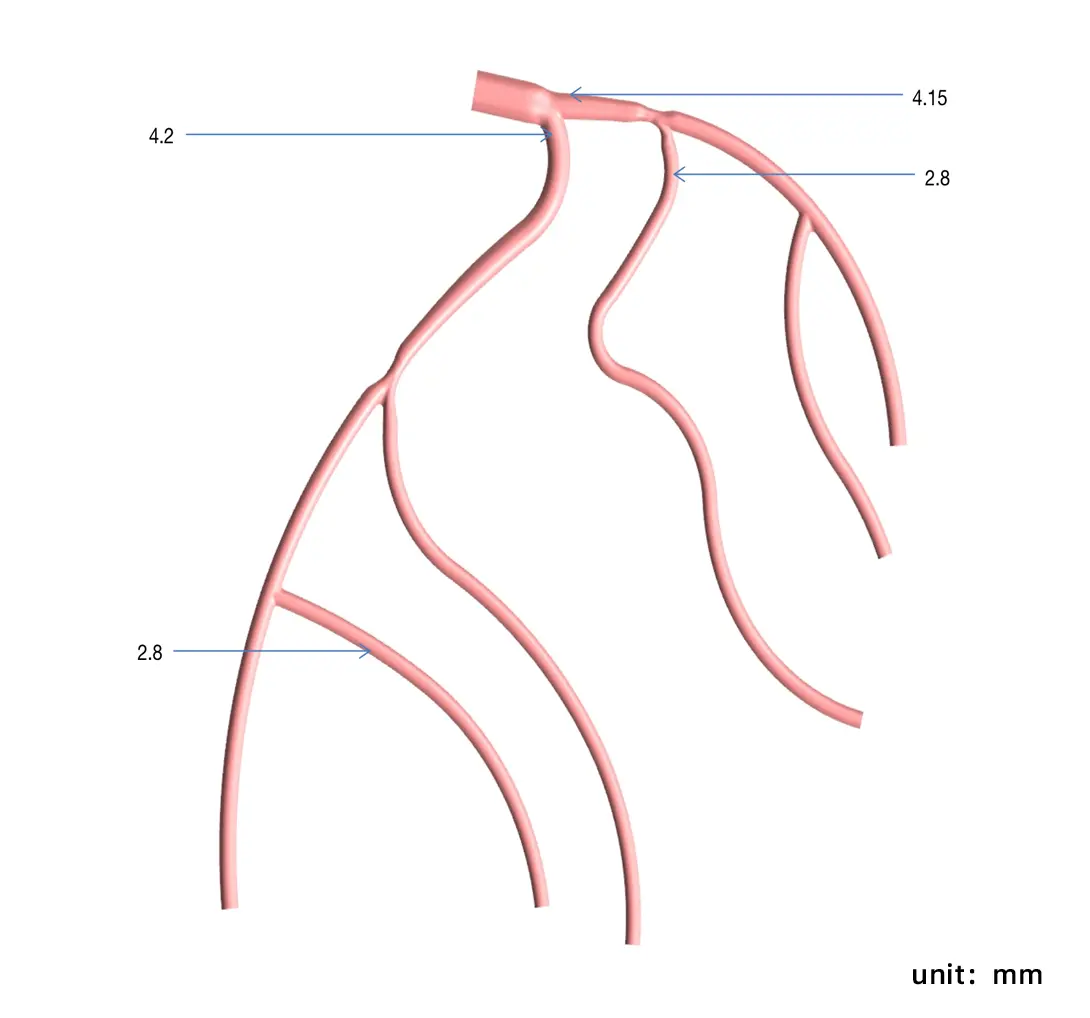 Main Dimensions of Planar Left Coronary Vessel Model (Radial Artery Approach)
