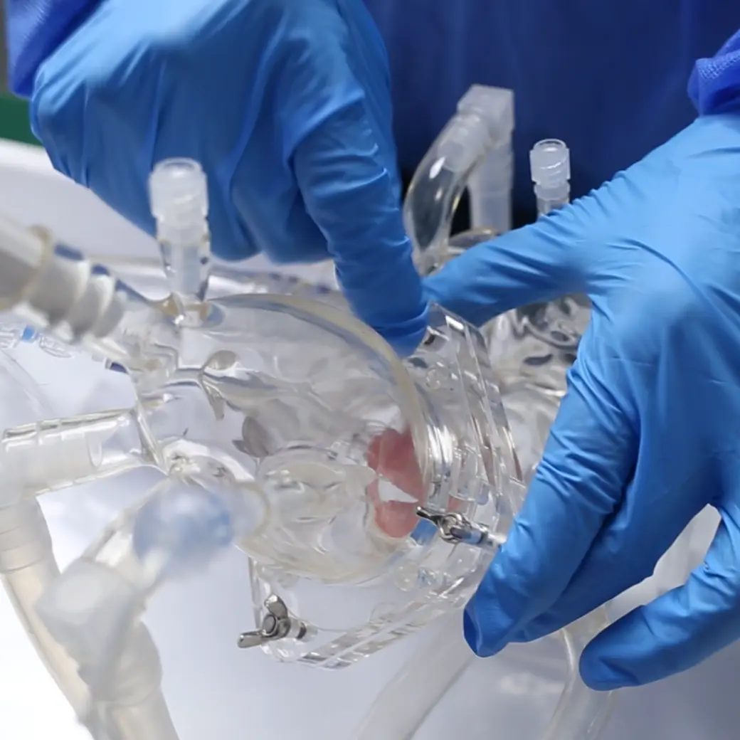 Transseptal Puncture Vessel Model - Type B