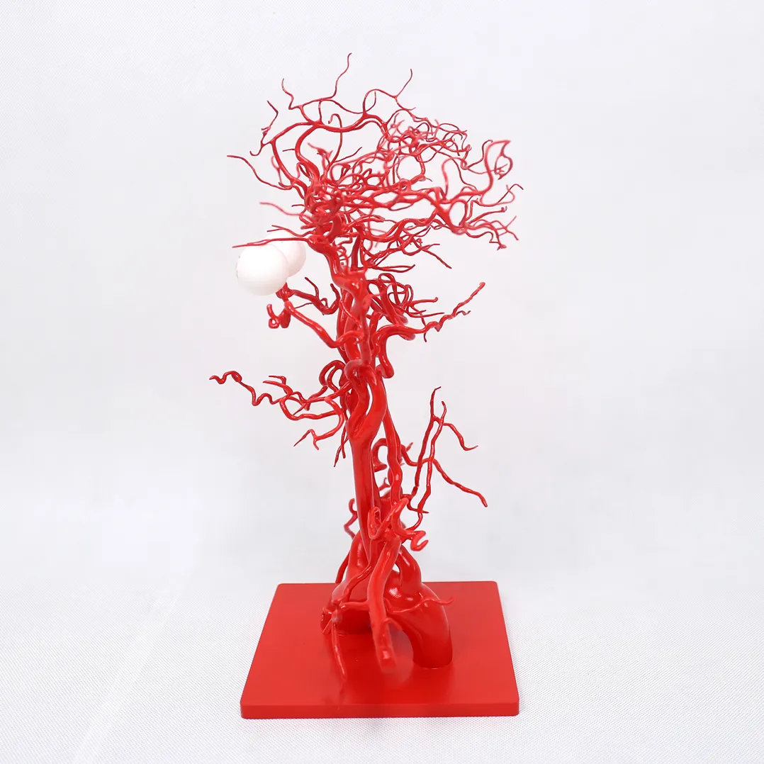 3d printing of intracranial arteries china