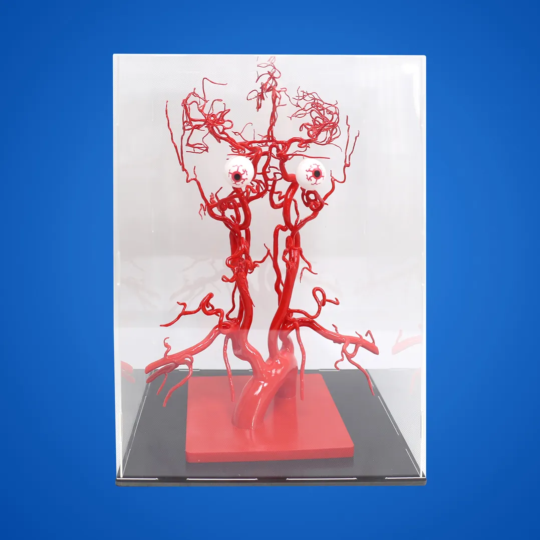 3d printing of intracranial arteries factory