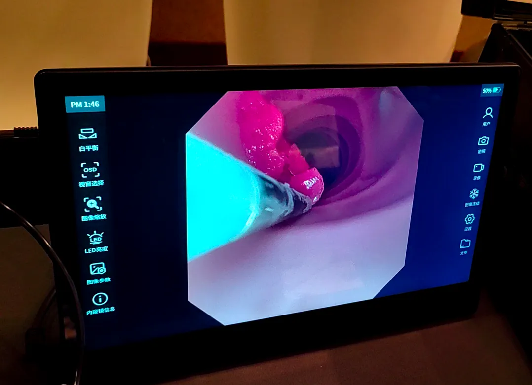 cryoablation gel lesion module cryoablation gel lesion module china