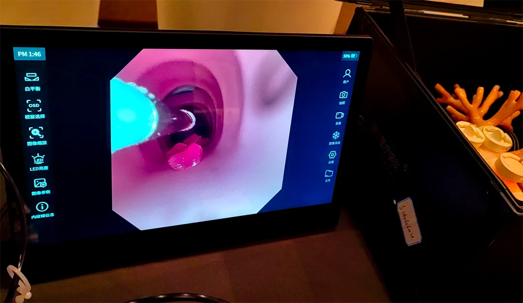 cryoablation gel lesion module supplier