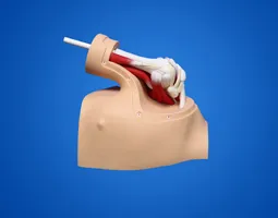 Training Model for Shoulder Arthroscopy Surgery