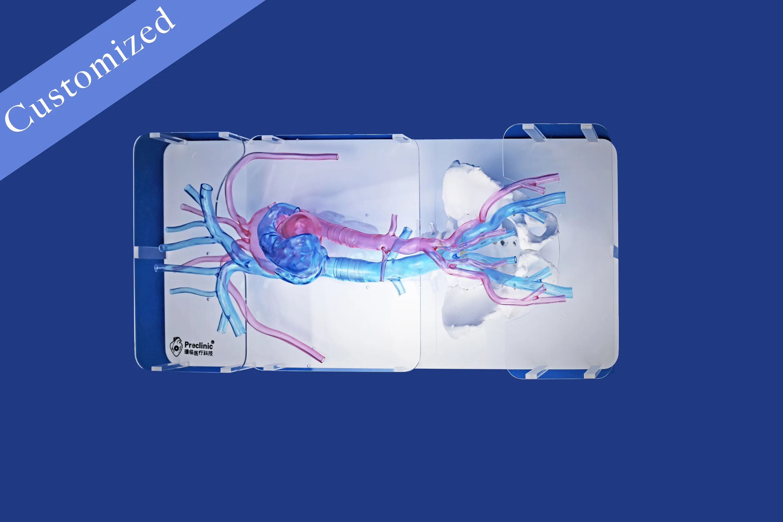 Customized Vascular Model