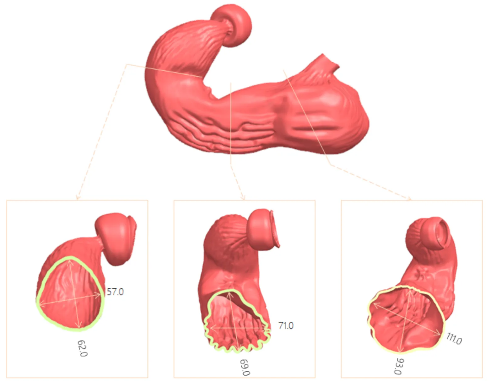 Drawing of Upper Gastrointestinal training model
