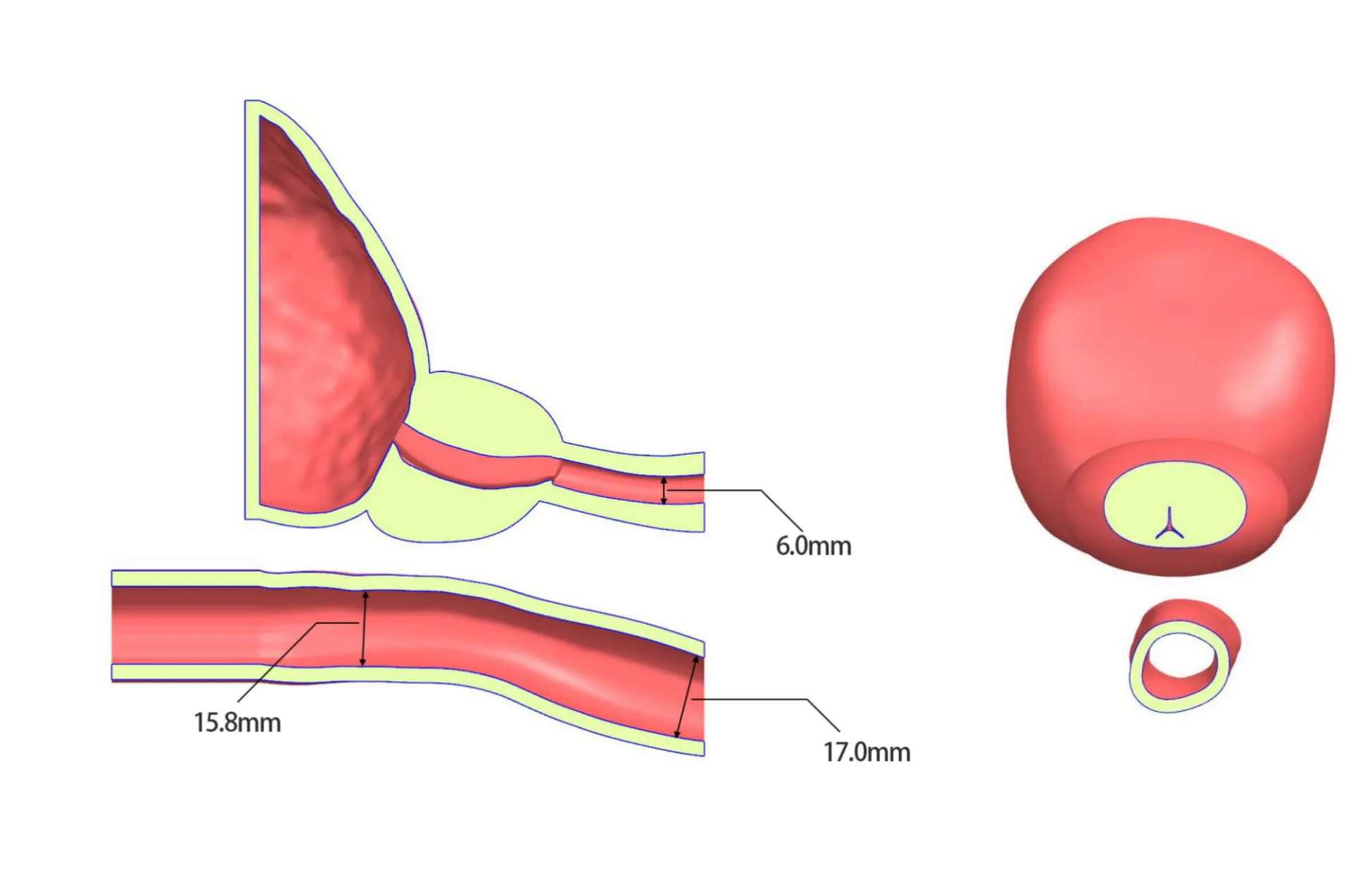 Drawing of Prostate ultrasound training model type A