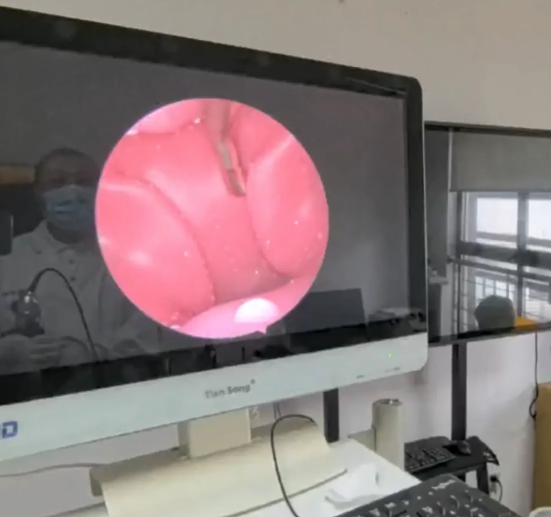 FAQ On ENT Endoscopy Training Model