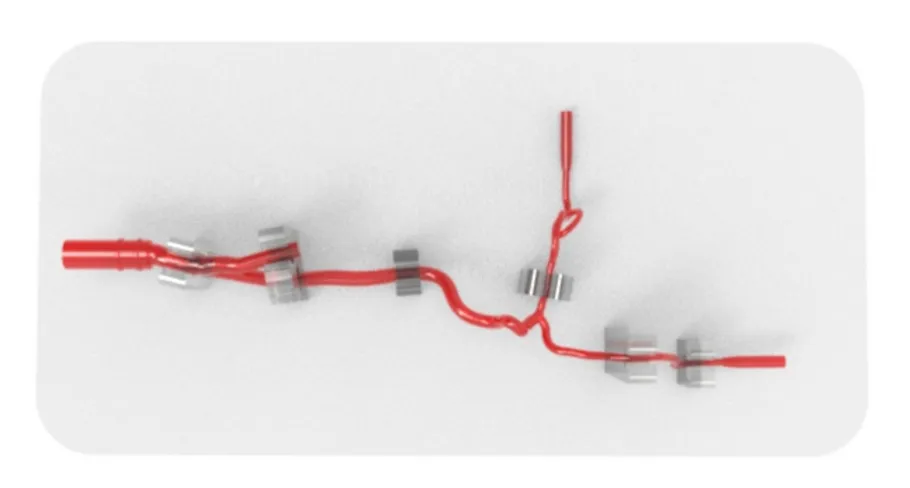 Drawing of Anterior Cerebral Circulation Vessel Model