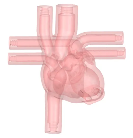 Drawing of Ultrasound Cardiac Training Model