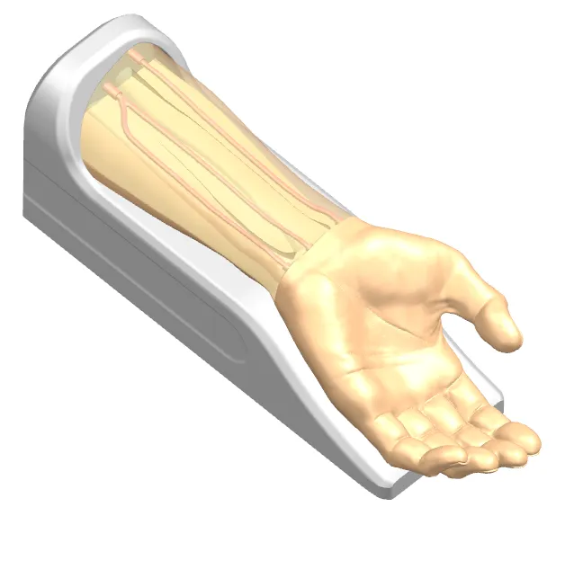 Drawing of Radial Artery Puncture Operation Model (Ultrasound-Guided)
