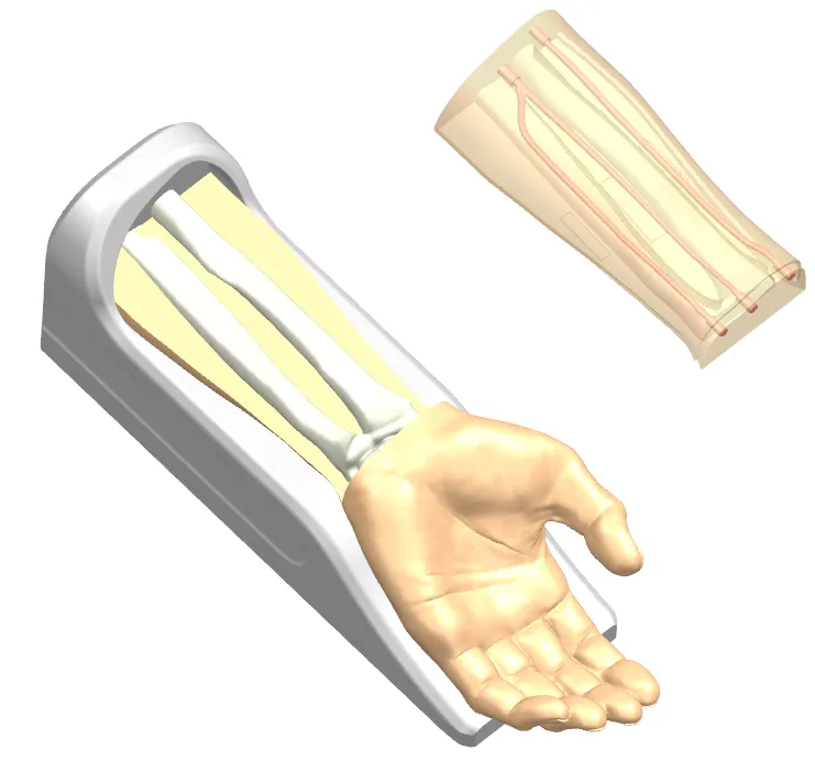 Drawing of Radial Artery Puncture Operation Model (Ultrasound-Guided)