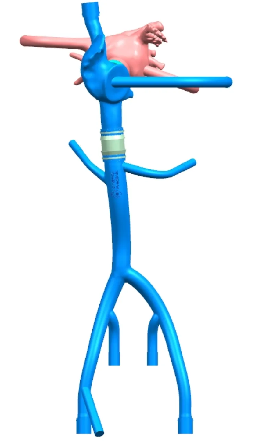 FAQ On Left atrial appendage training model