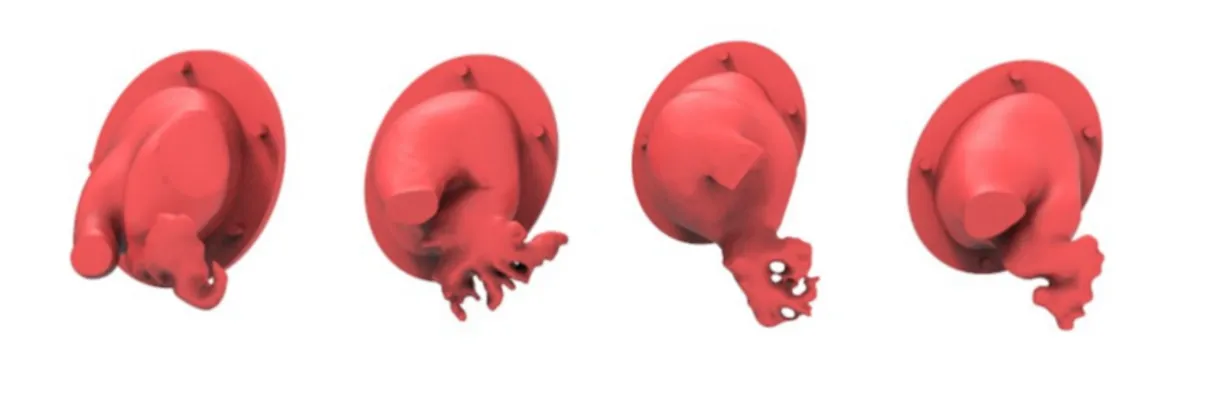 FAQ On Left atrial appendage training model